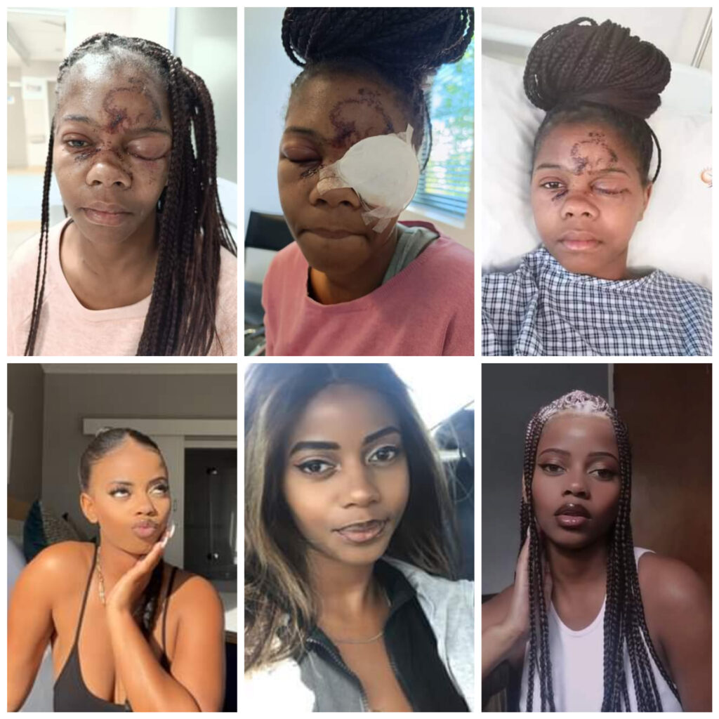 25-yr-old South African lady assaulted with brick by man after she refused his approach