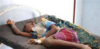 FG alerts Nigerians to cerebrospinal meningitis resurgence, urges public to take precaution during dry season