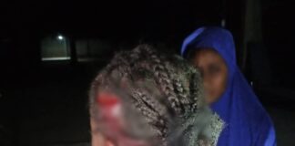 UNIMAID student allegedly attacks 21-yr-old student for rejecting his love proposal (Graphic Photos)