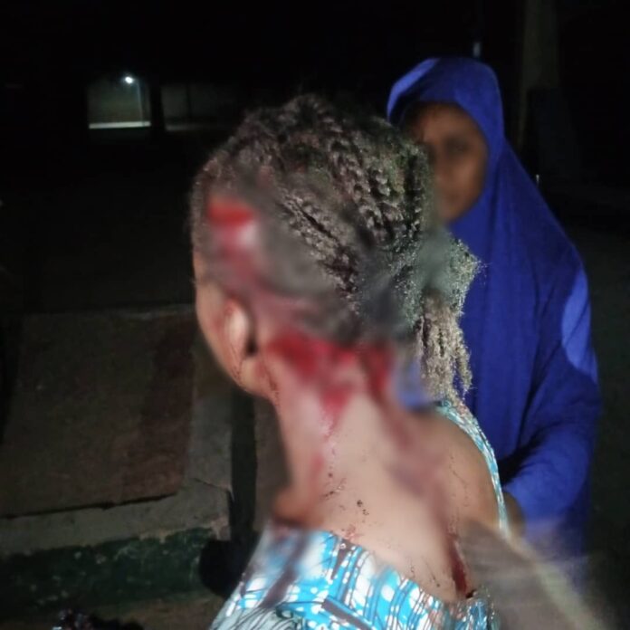 UNIMAID student allegedly attacks 21-yr-old student for rejecting his love proposal (Graphic Photos) UNIMAID student allegedly attacks 21-yr-old student for rejecting his love proposal (Graphic Photos)