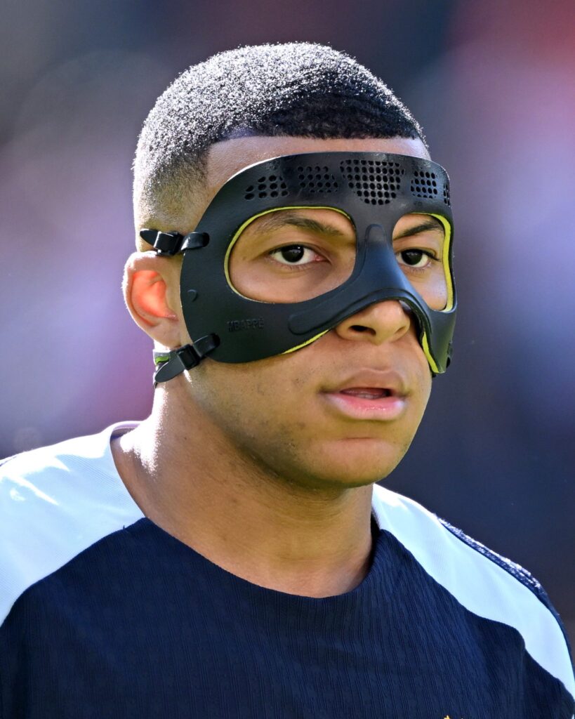 Kylian Mbappe wearing face mask (Photo Credit: UEFA EURO/X)