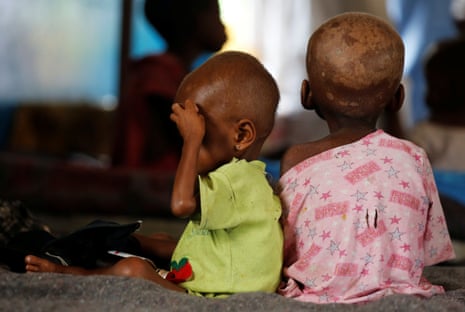 Internally displaced children with severe acute malnutrition wait to receive medical attention at a hospital in Kasai-Oriental province, DRC. Photograph: Thomas Mukoya/Reuters