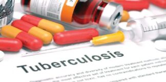 Tuberculosis not spiritual, can be cured – FG reassures Nigerians Tuberculosis