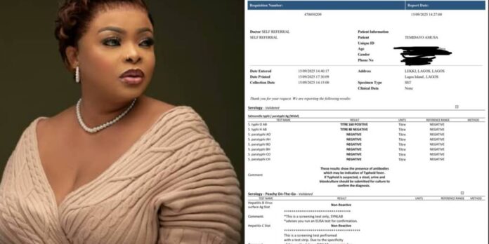 It’s better to know your status – Dayo Amusa shares HIV test results Dayo Amusa and her HIV test results