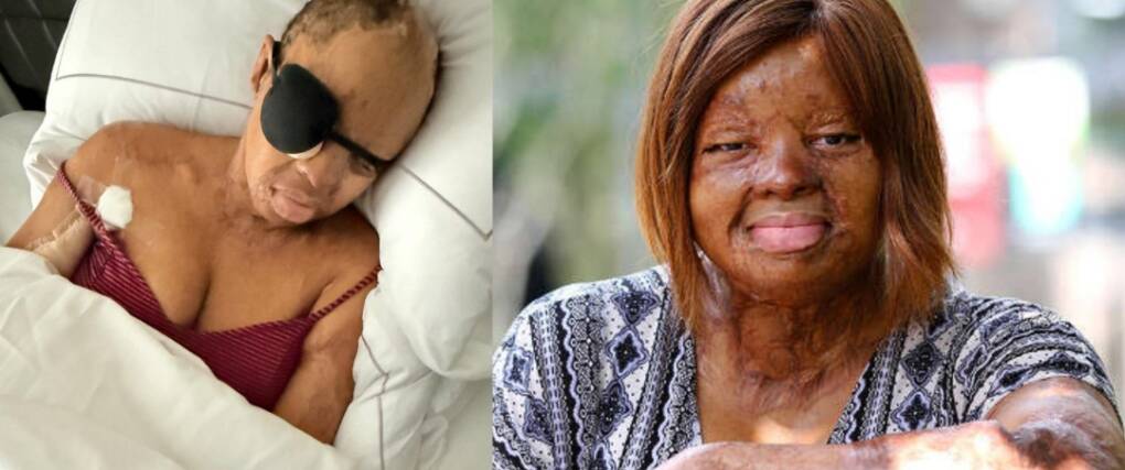 Screenshot_20250915-112010 Sosoliso plane crash survivor and singer, Kechi Okwuchi