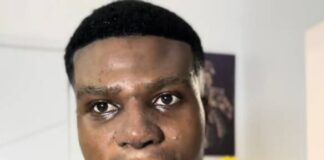 How nose surgery changed my career and boosted my confidence – Zic Saloma Zic Saloma has explained his reason for undergoing a plastic surgery.